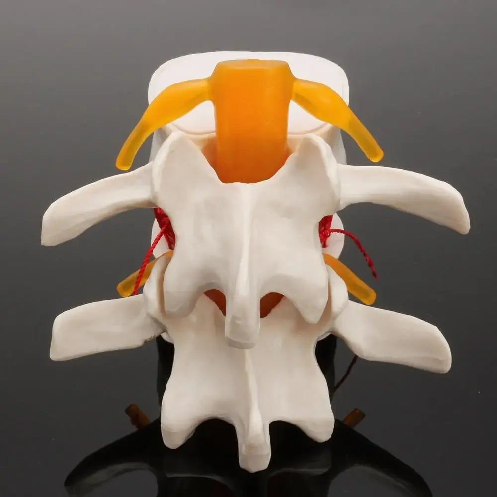 Model Anatomic Disc Intervertebral