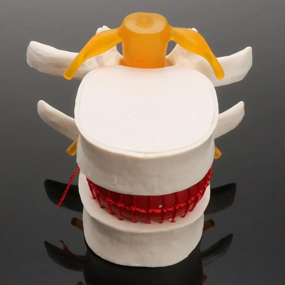 Model Anatomic Disc Intervertebral