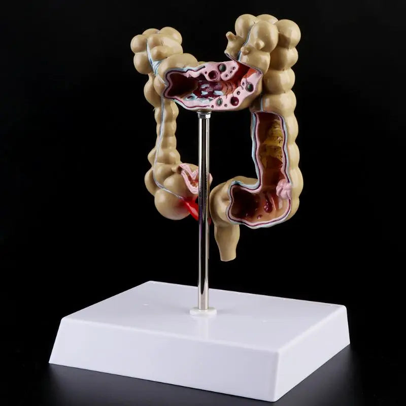 Model Patologic Colon și Rect
