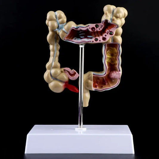 Model Patologic Colon și Rect