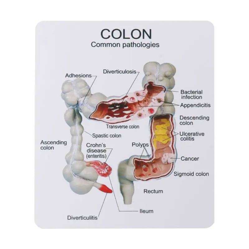 Model Patologic Colon și Rect