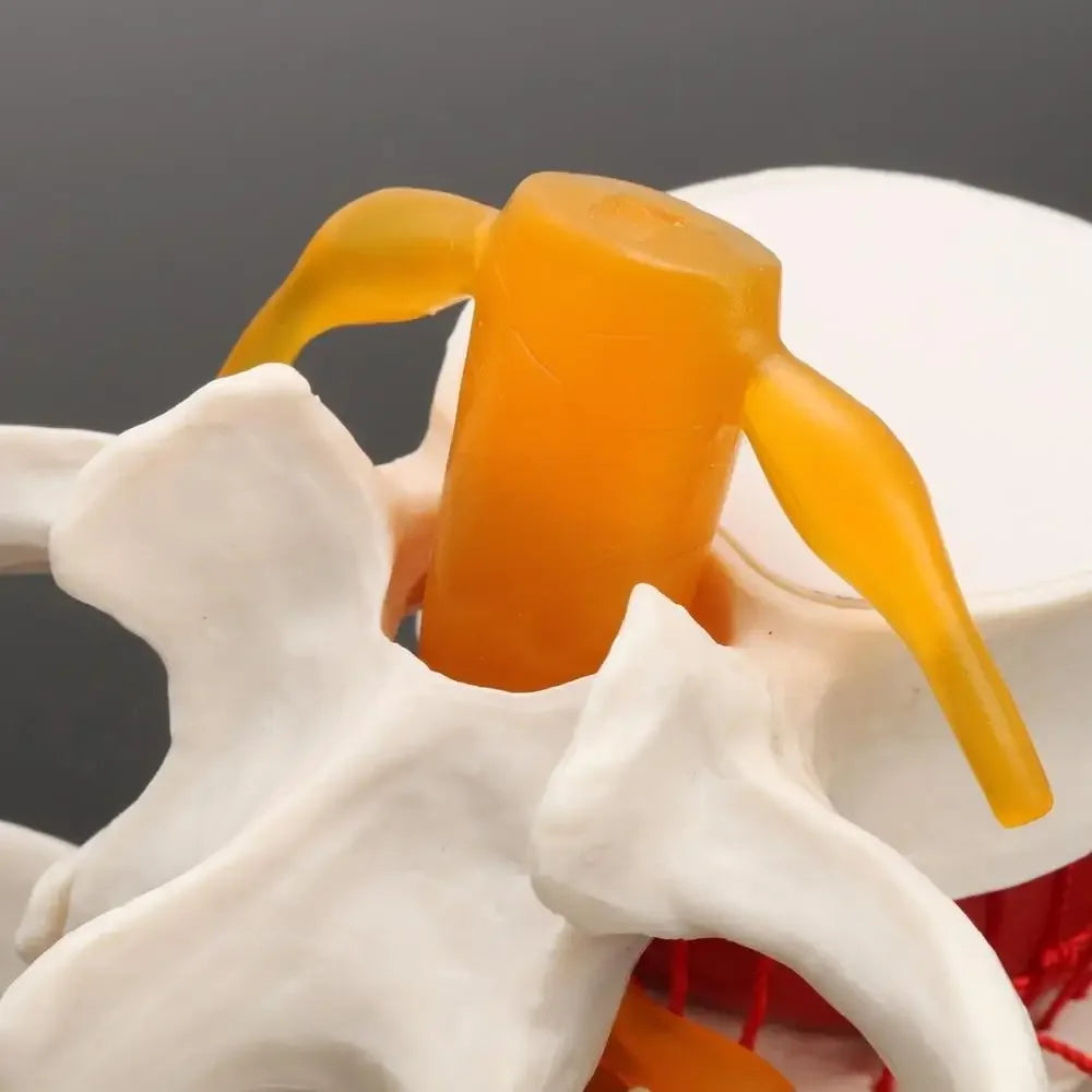 Model Anatomic Disc Intervertebral