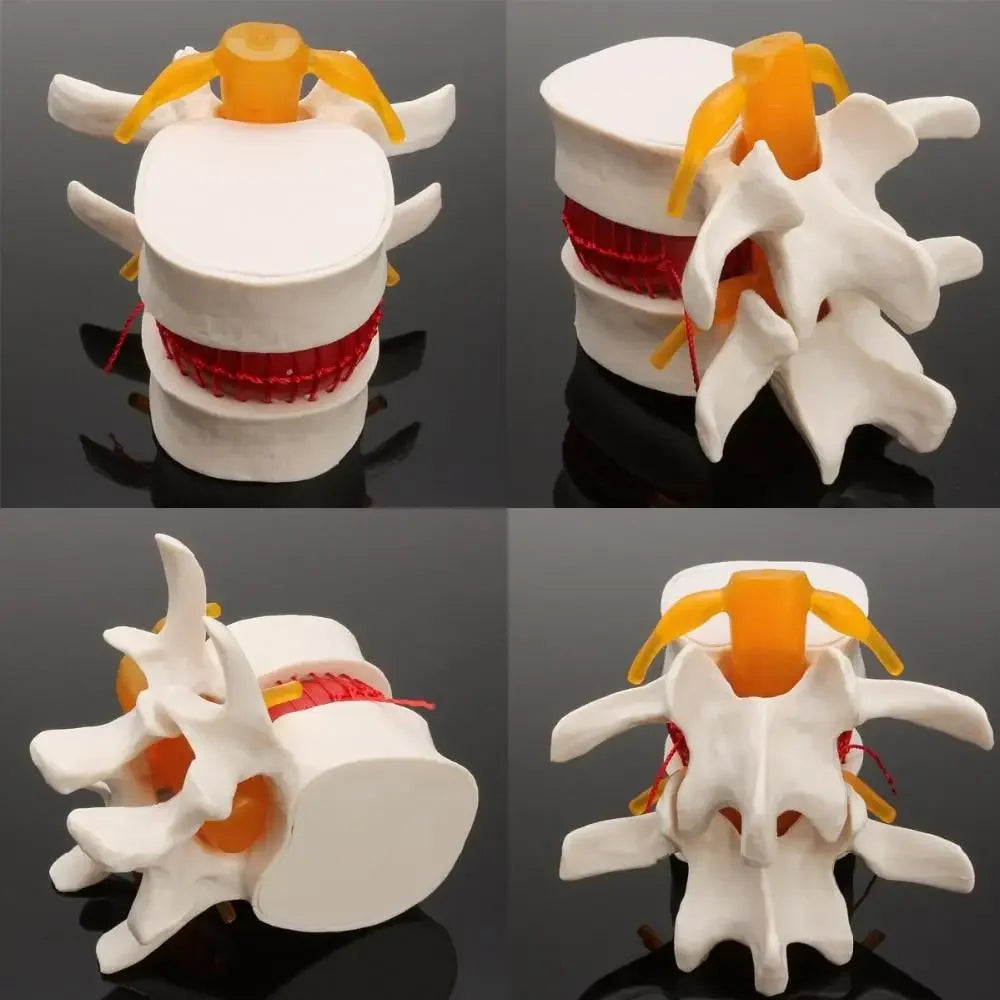 Model Anatomic Disc Intervertebral