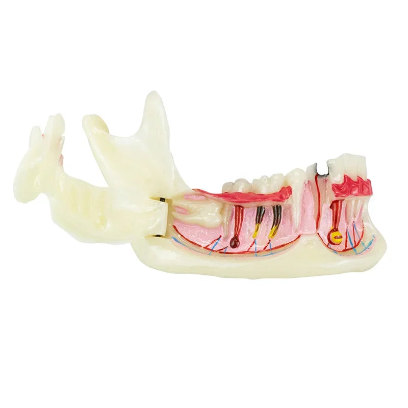Model Dentar cu Gingie
