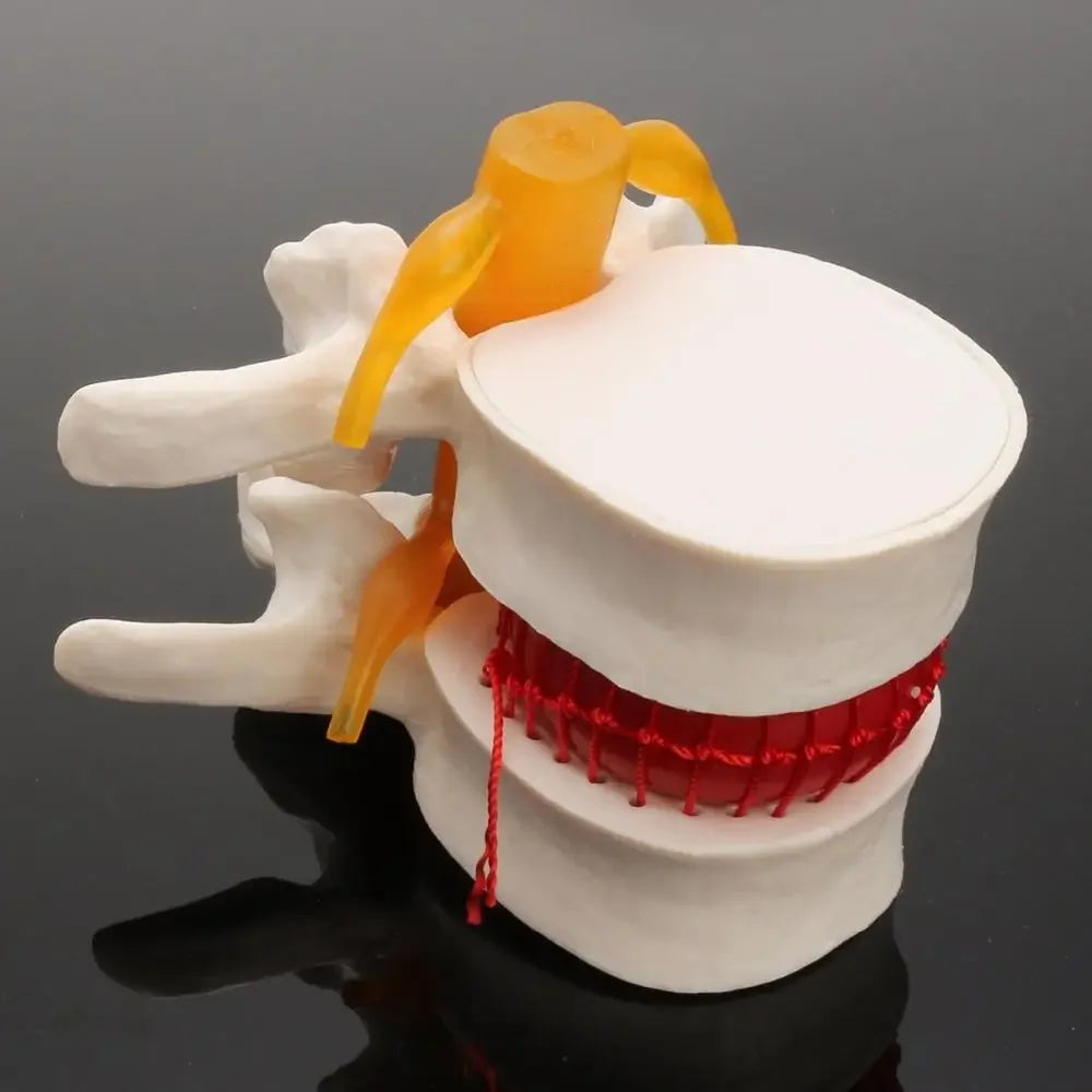 Model Anatomic Disc Intervertebral