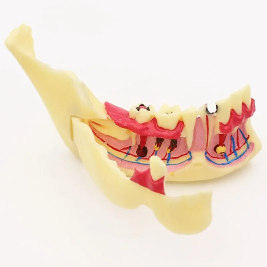 Model Dentar cu Gingie