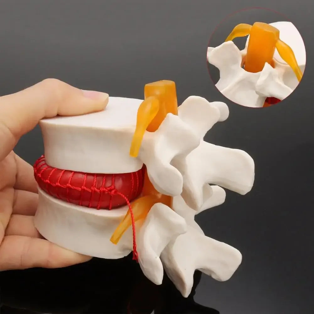 Model Anatomic Disc Intervertebral