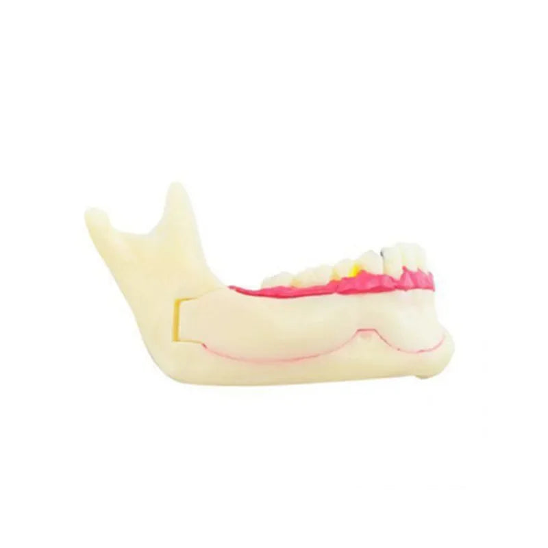 Model Dentar cu Gingie