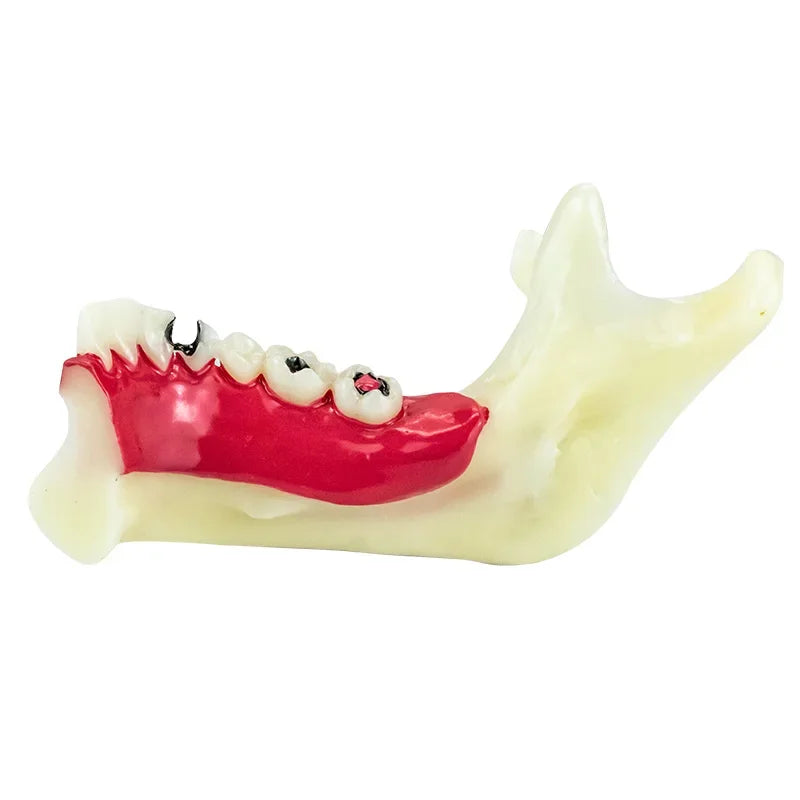 Model Dentar cu Gingie